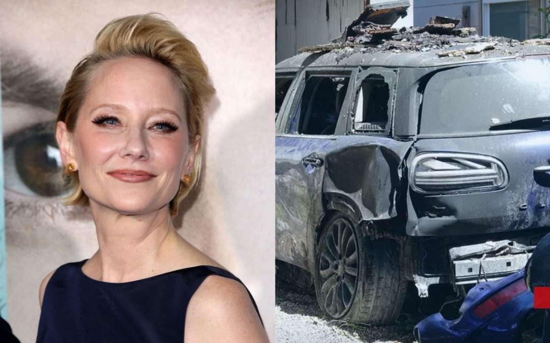 Anne Heche en estado crítico al chocar contra una casa