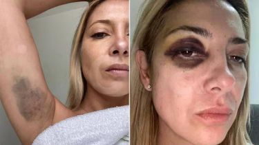 Denuncia contra Alberto Fernández: las fotos y chats de la violencia contra Fabiola Yañez